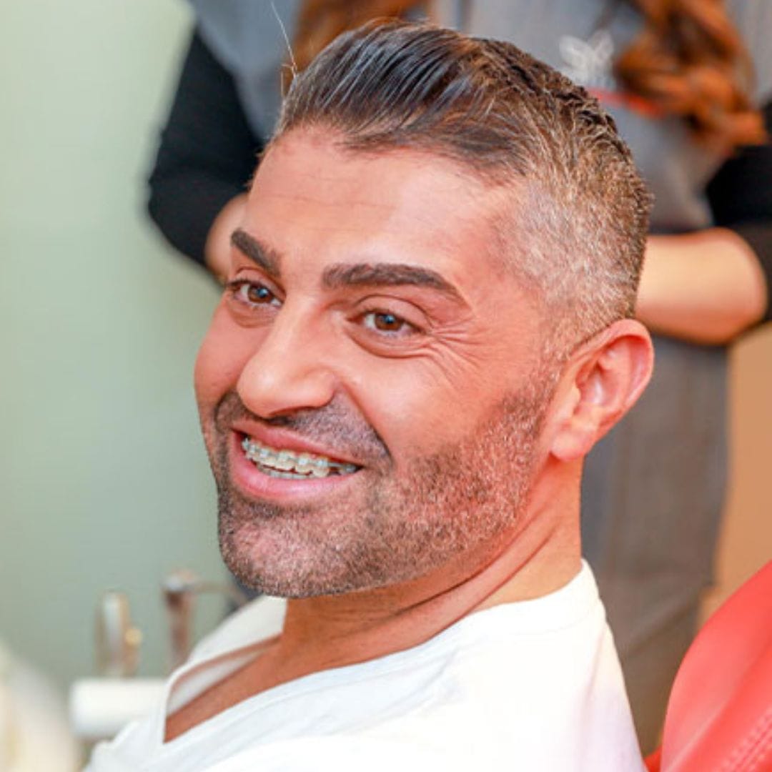 adult man wearing braces